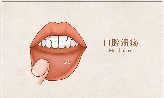 大名鼎鼎的牛黄清心丸，不止清心化痰，还能用于治疗这6种病