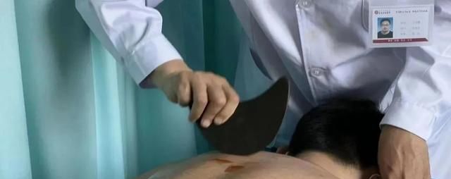 小小砭石 大有妙用！东城中医医院针灸科砭石疗法正式上线啦