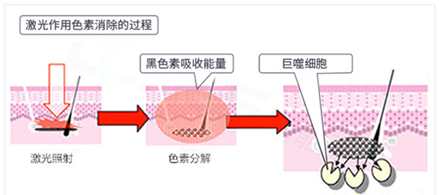 白瓷娃娃拯救破败肌肤，尽显净透无瑕