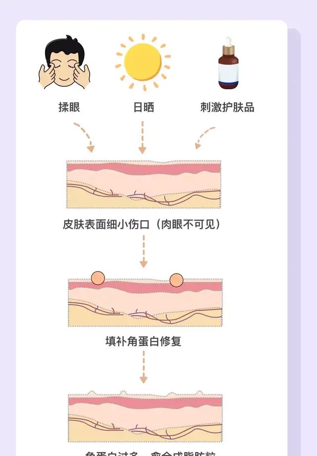 粟丘疹、汗管瘤、扁平疣哪种才是脂肪粒，爱美前先学会分清小疙瘩