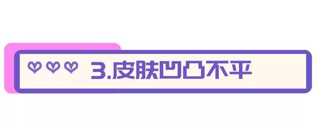 抗衰“新宠”热玛吉，功效真有这么神奇？别急！先了解这些再行动