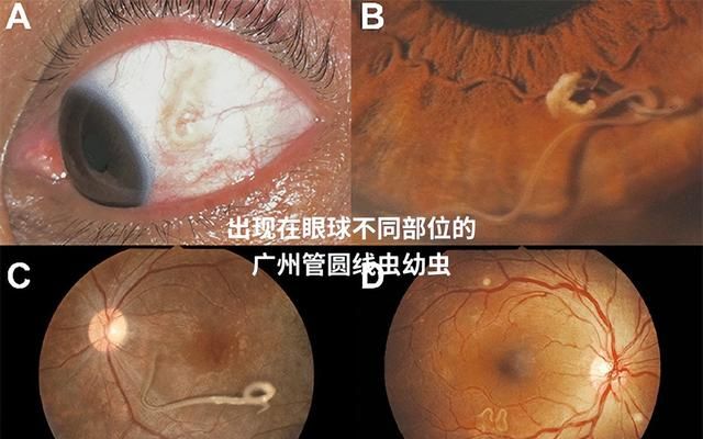 真图预警：一口生鱼片，能吃到哪些寄生虫？