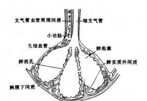 肺纤维化病有多严重图2