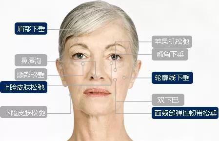 给大家科普一下埋线提升和拉皮手术、注射除皱的区别