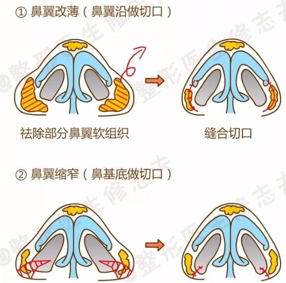 鼻子大是什么原因(找男友要找鼻子大的什么原因)图6