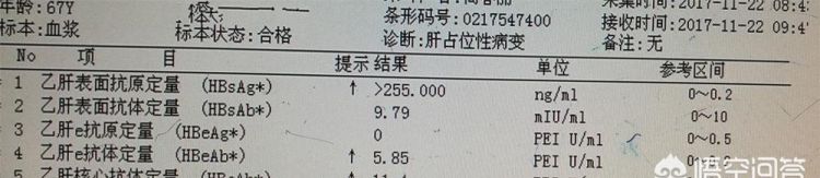 乙肝携带者和乙肝大三阳有什么区别图1