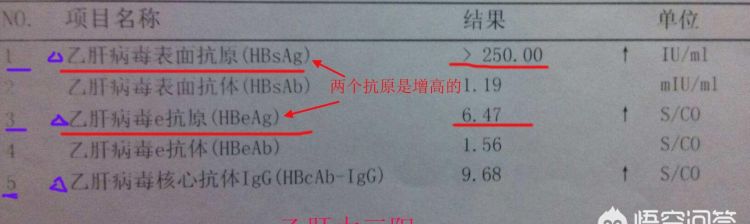 乙肝携带者和乙肝大三阳有什么区别图4