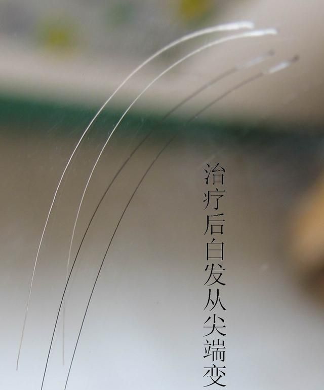 感冒 吃什么，感冒为什么叫感冒呢图4