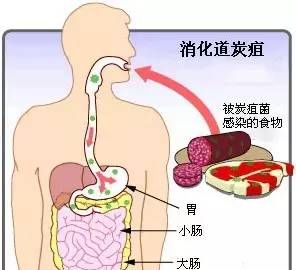 皮肤炭疽怎么知道,皮肤炭疽如何防图3