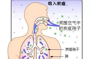 皮肤炭疽怎么知道,皮肤炭疽如何防图4