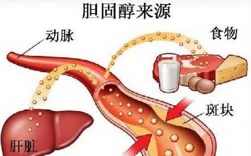 胆固醇高吃什么好食谱,胆固醇高吃什么好喝什么茶图1