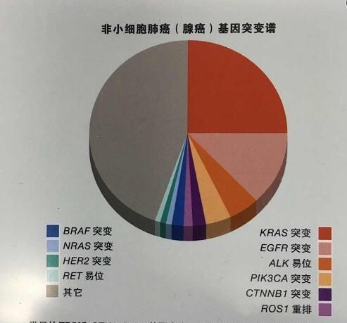 肺癌晚期可以治好吗?有奇迹发生吗?图2