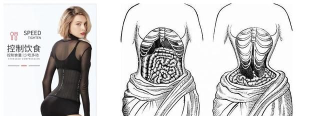 辟谣：网红名人推荐的束腰能减肥瘦腰？那纯是歪理邪说