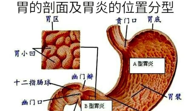 胃炎患者吃什么养胃,有萎缩性胃炎的吃哪些食物最养胃图5