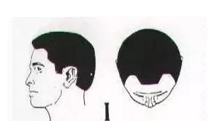 有什么简单的办法可以防止脱发(防止脱发和快速生发的方法)图14