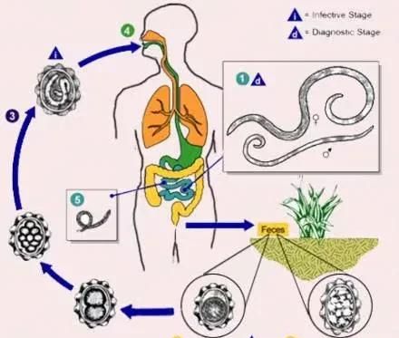 肚子里有蛔虫有什么特征,肚子里有虫子的表现图1