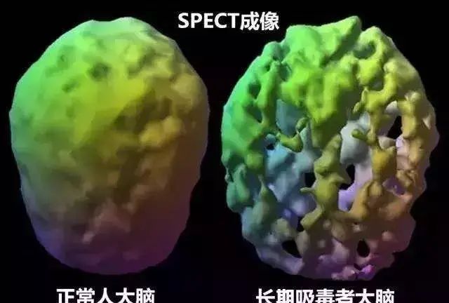 为什么吸食冰毒、麻古容易出现幻觉幻听、被害妄想等症状？