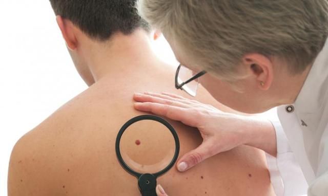 医生详解常见的皮肤病：种类和治疗
