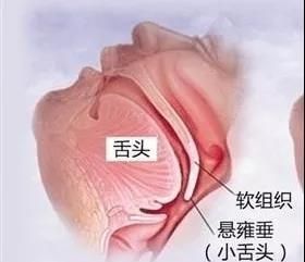 睡觉打呼噜怎么办(睡觉爱打呼噜怎么办)图4