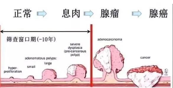 肠息肉切除术后有哪些注意事项,肠息肉切除手术后注意事项有哪些图1