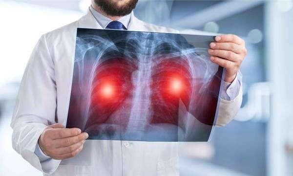 肺癌容易复发的根本原因是什么,肺癌复发一般哪个部位容易复发图5