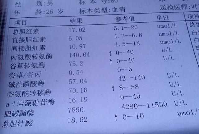 谷丙转氨酶偏高有什么症状(谷丙转氨酶偏高发生哪些症状)图5