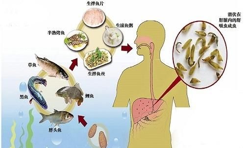 生鱼片里的肝吸虫,到底有什么危害呢图2