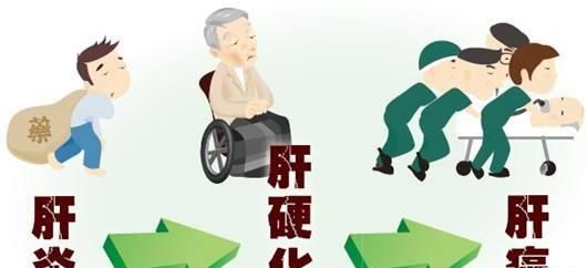 什么是戊型病毒性肝炎图3