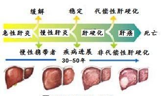 什么是戊型病毒性肝炎图4