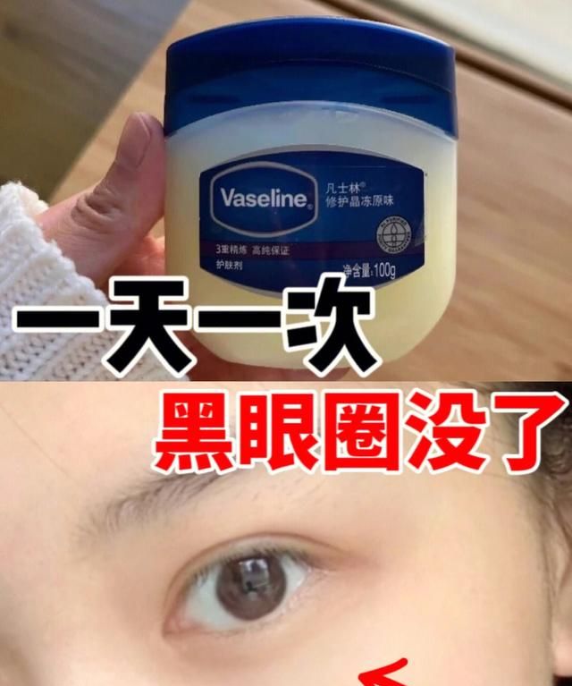去除黑眼圈的方法有什么,怎样去除黑眼圈最有效家用方法图1