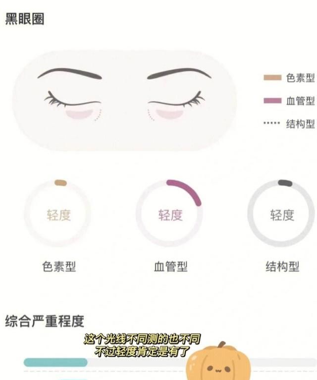 去除黑眼圈的方法有什么,怎样去除黑眼圈最有效家用方法图5