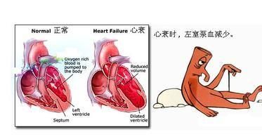 心衰的症状有哪些,心衰的症状有哪些悟空问答图4