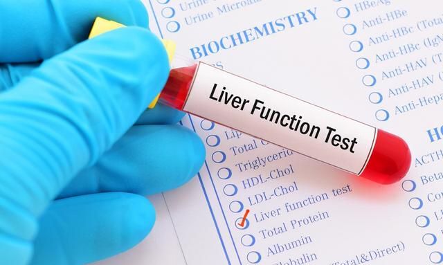 肝功能检查能看出多种疾病？这4个指标，医生教你一眼看出异常