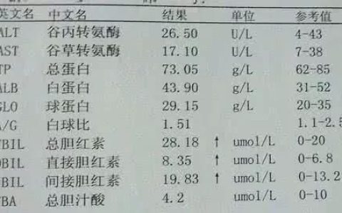 胆红素偏高是什么原因引起的(总胆红素间接胆红素偏高原因)