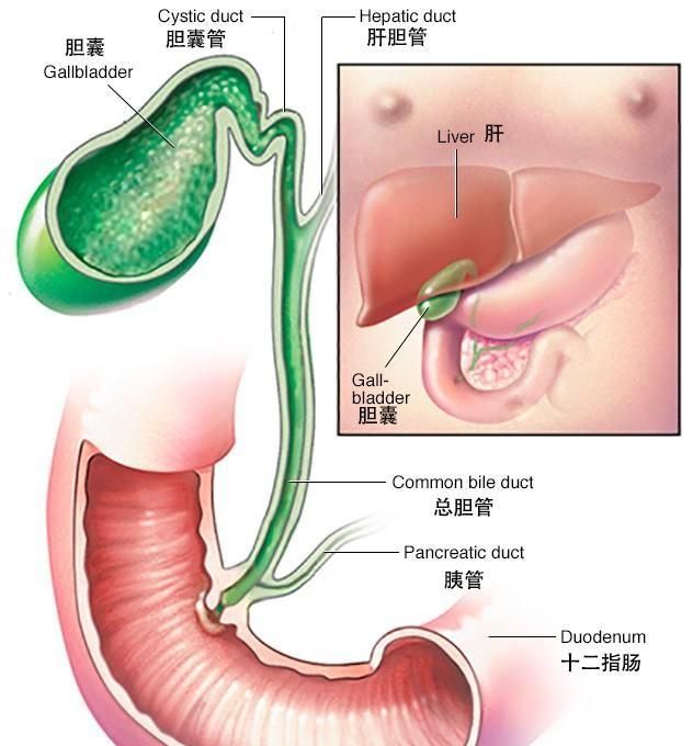 胆管肿瘤能治好吗,胆囊胆管肿瘤能治好吗图3