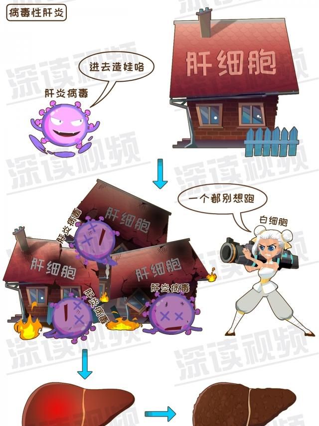 早期诊断肝硬化的主要依据图4