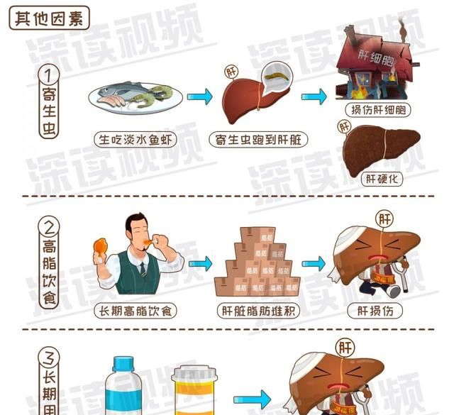 早期诊断肝硬化的主要依据图10