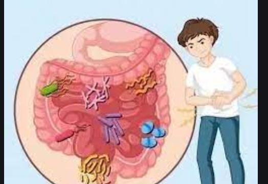 肠胃功能紊乱的症状有哪些图2