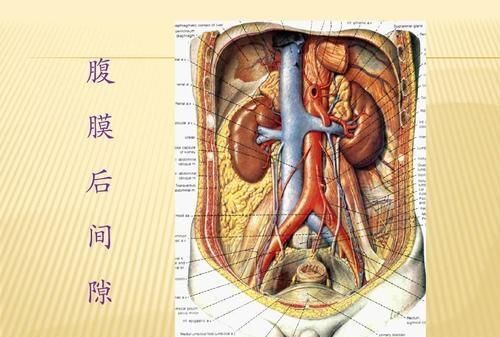 腹膜后肿瘤怎么办图1