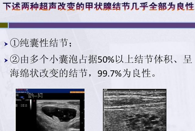 #秋补#如何通过饮食调理甲状腺结节图2
