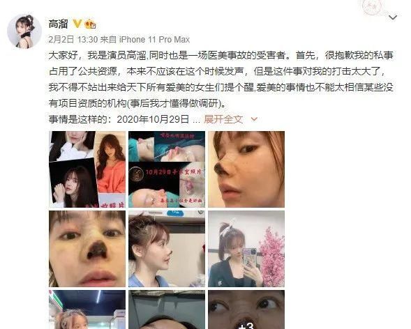女演员自曝整形失败致鼻头坏死！官方通报来了
