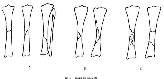胫腓骨骨折内固定多久能恢复,胫腓骨骨折外固定需要多久恢复图1