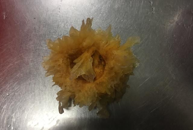 清肺美容的红枣银耳汤