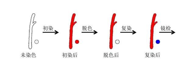 早期如何发现肺结核图2