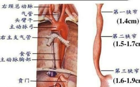 得了食管癌,需要手术吗多少钱(食管癌手术最好的医院)