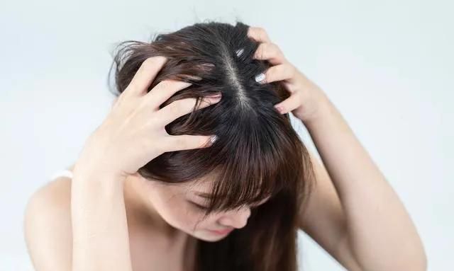 中年女性脱发严重怎么治,中年女性脱发怎么治疗图1