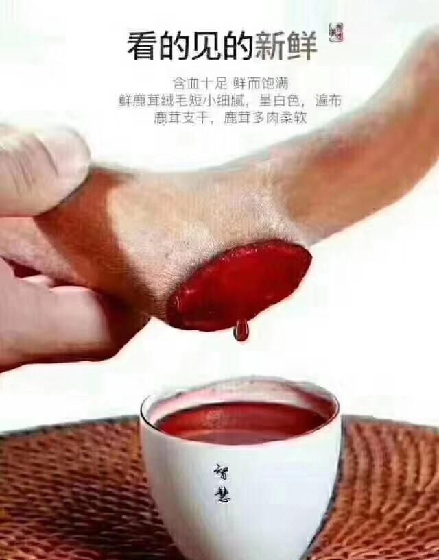 人免疫力下降怎么办呢,人的免疫力下降补什么最快图1