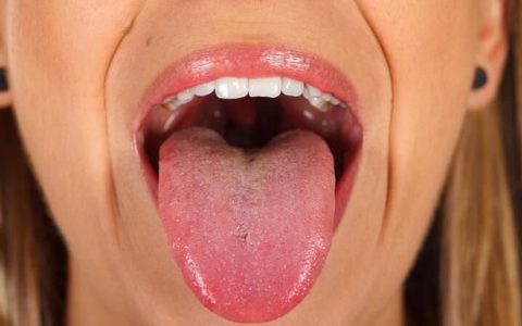 舌头出现这些变化暗示你生大病了