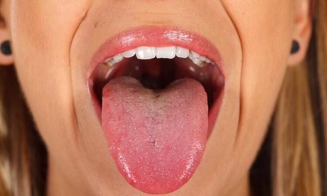提醒：舌头出现这5个变化，暗示你生“大病”了！赶紧治疗