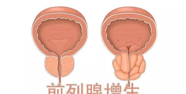 金匮肾气丸，不仅利水消肿，还能用于治疗这五种病